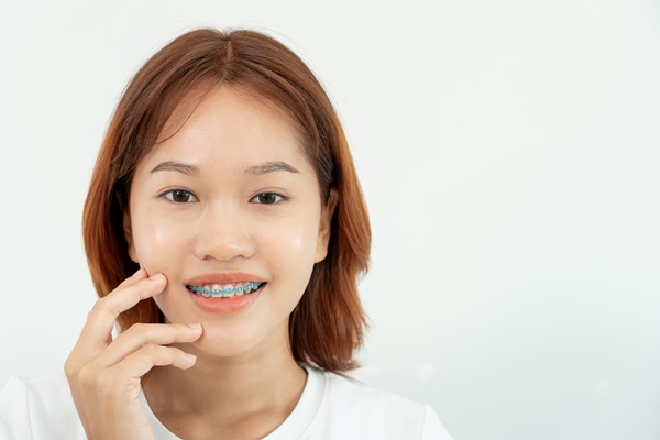 What To Expect With Ceramic Braces: Treatment Process And Care Tips